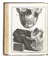 DENTISTRY  HUNTER, JOHN. The Natural History of the Human Teeth. 1771 + A Practical Diseases on the Diseases of the Teeth.  1778